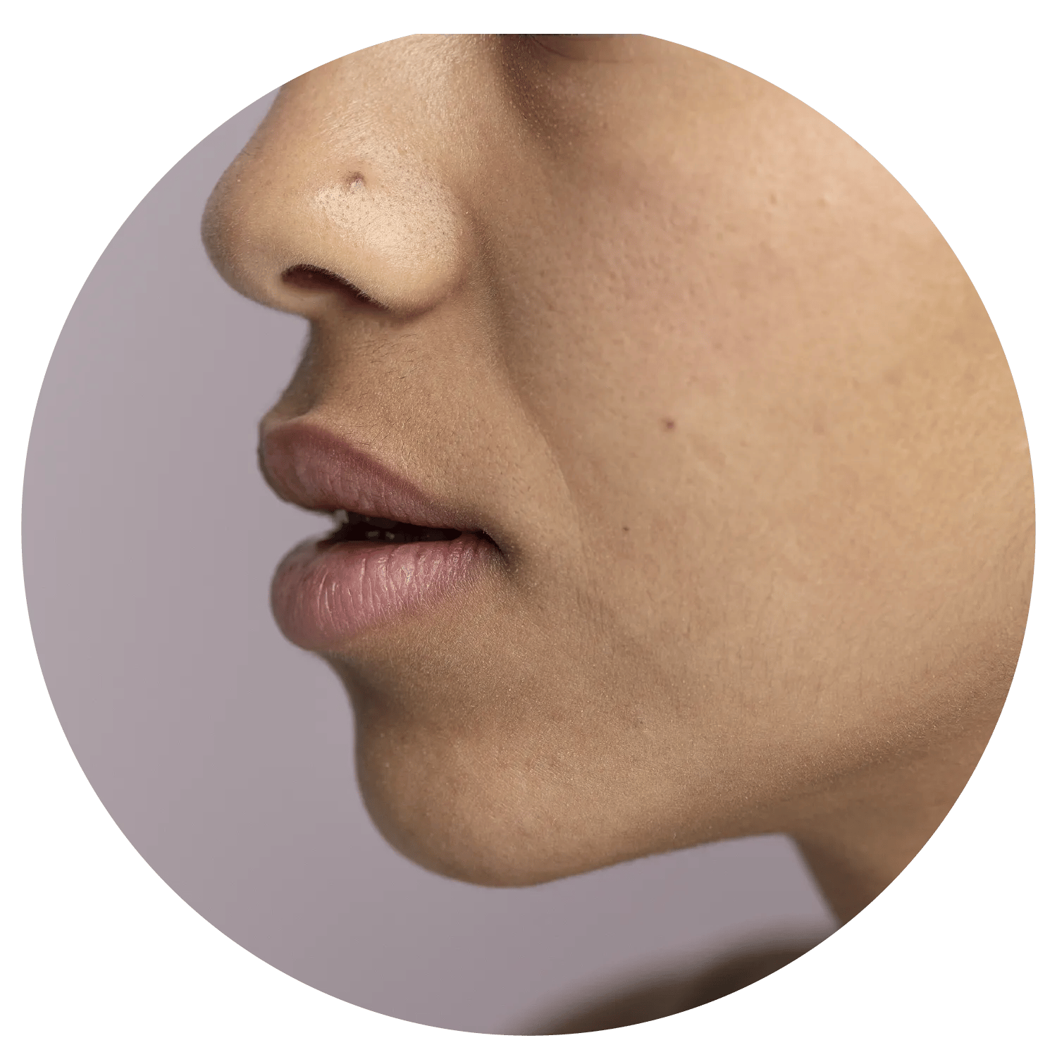Smile Lines treatment process at Toronto medical spa - Understand the deeper factors behind smile lines